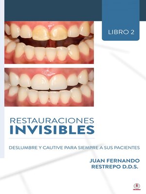 cover image of Restauraciones Invisibles